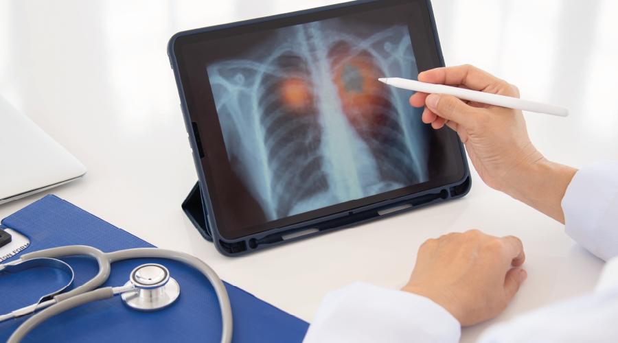 Elektronik sigarada büyük tehlike